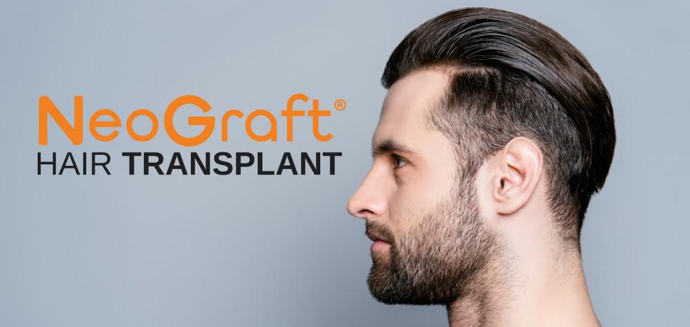If You're Experiencing Hair Loss, Consider NeoGraft® -