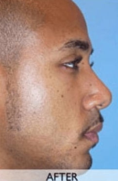 After Nose Jon Orange County After Nose Jon Orange County
