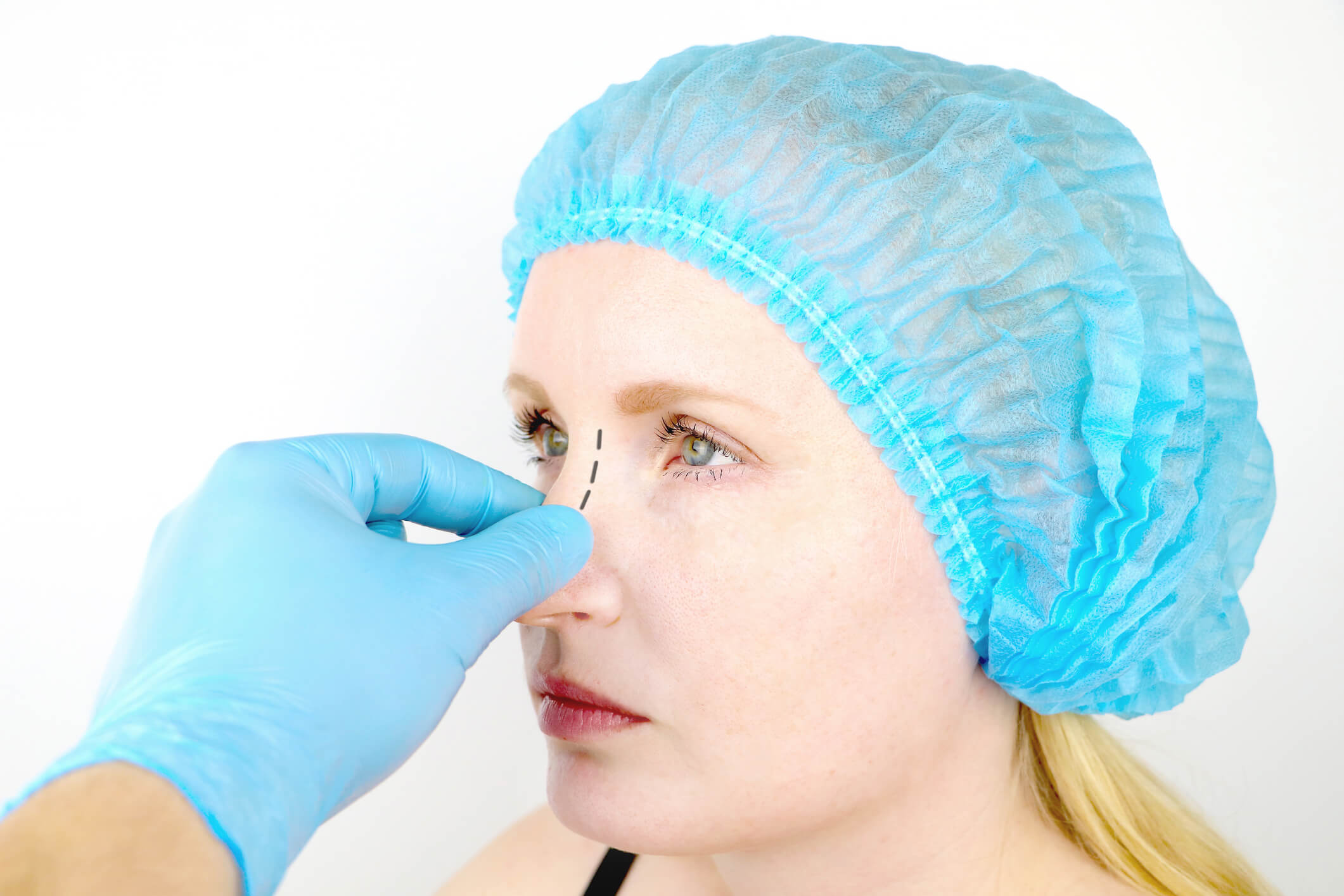 Nose Surgery Newport Beach Nose Surgery Newport Beach
