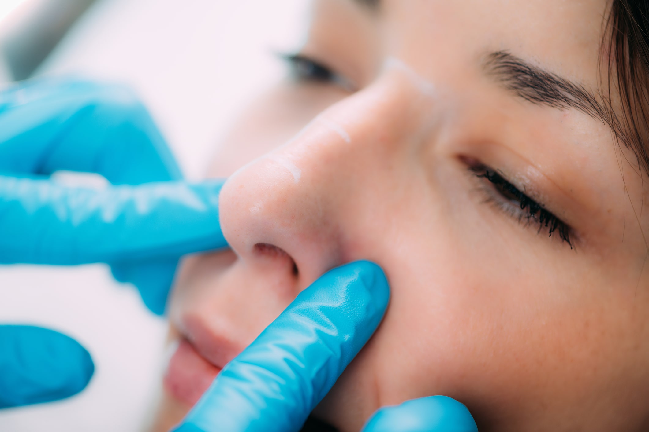 Dermal Fillers