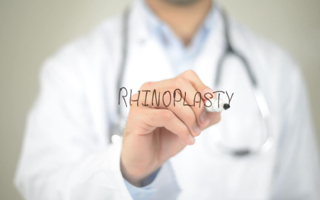 How To Prepare For Your Newport Beach Rhinoplasty