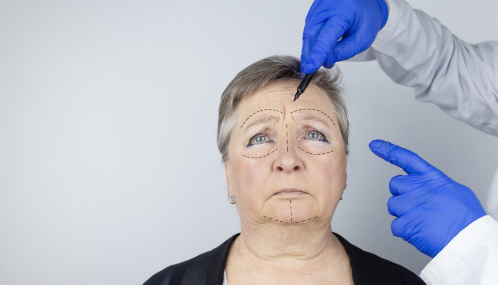 Image showing age-related differences in rhinoplasty outcomes provided by Dr. George Brennan in Orange County California